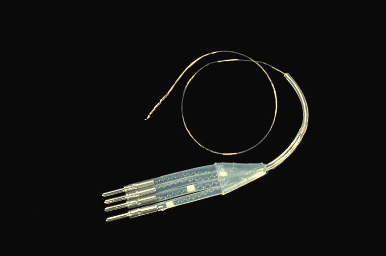 Episode 78 - Medtronic neurostimulation history, image 1