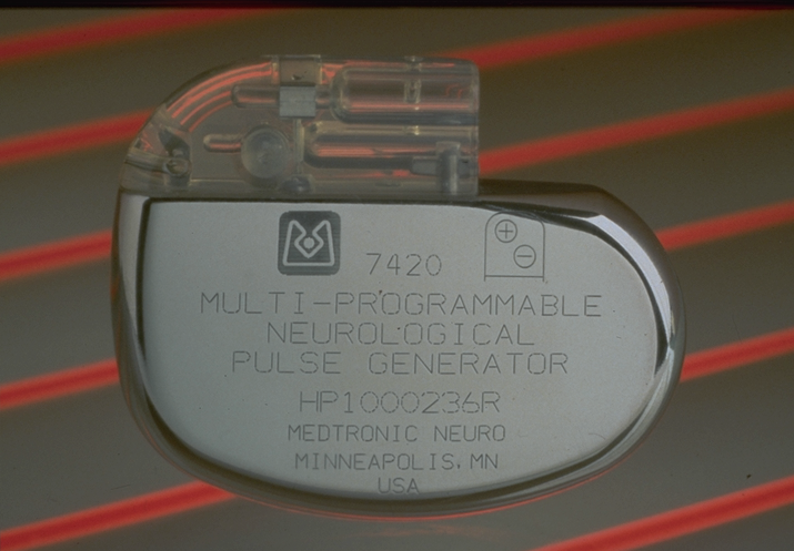 Episode 78 - Medtronic neurostimulation history, image 3