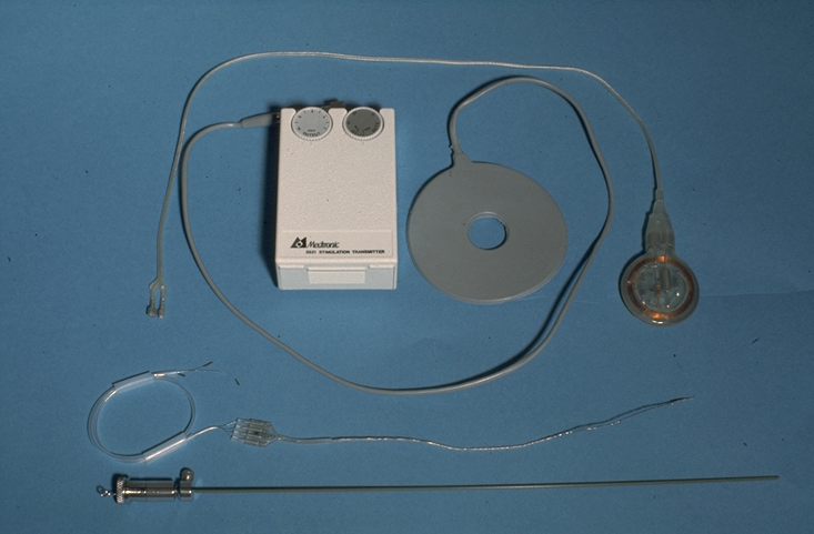 Episode 78 - Medtronic neurostimulation history, image 4